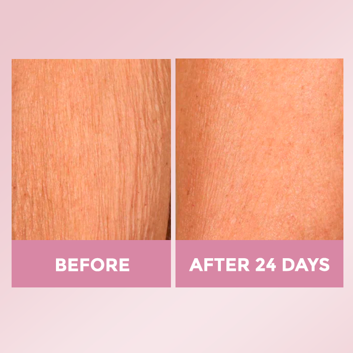 Luxe Skin Lift Cream